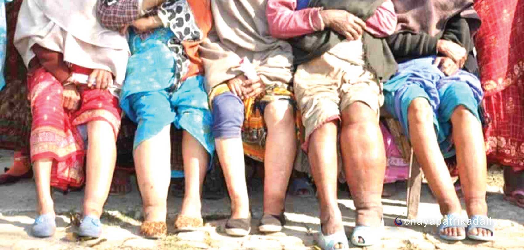 बाँकेसहित १२ जिल्लामा हात्तीपाइले रोगविरुद्धको औषधि खुवाइने