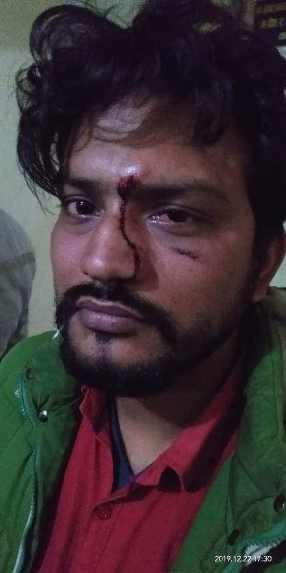 नेकपाका नेताद्वारा पत्रकारमाथि कुटपिट