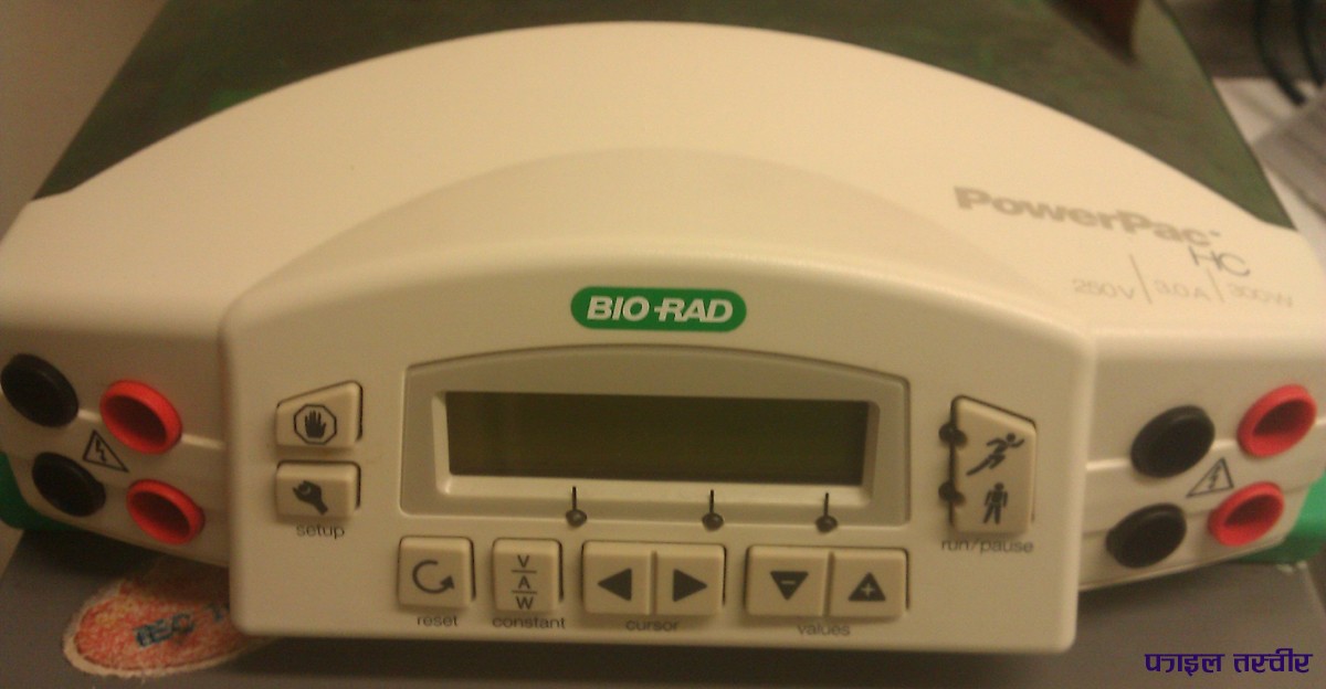 मेशिन नहुँदा विरामी चर्को मूल्य तिर्न बाध्य