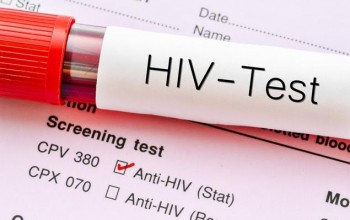 नेपालमा प्रत्येक दिन दुईजना एचआईभी संक्रमित मर्छन्