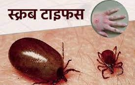 ‘कोरोना नेगेटिभ आयो भनेर ढुक्क नहुनुस्, ‘स्क्रब टाइफस’को परीक्षण गराउनुस्’